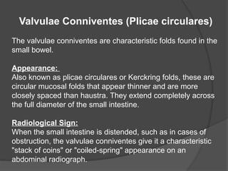 Valvulae Abdominal X-RAYS- view , surgery point of view | PPTX