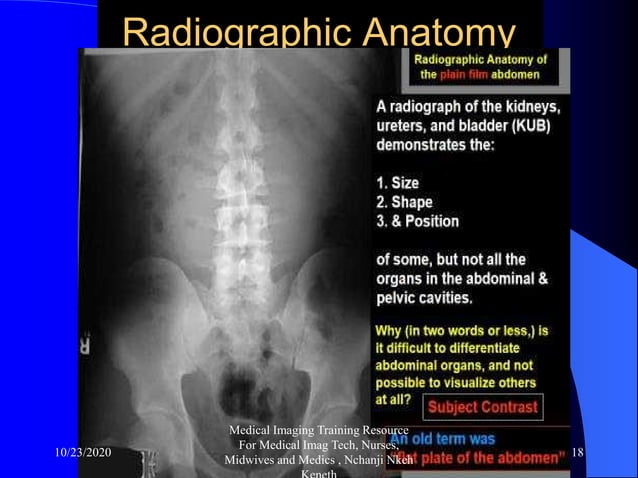 Abdominal x ray axr radiology training resource nchanji nkeh keneth | PDF