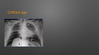 CUPOLA sign
 