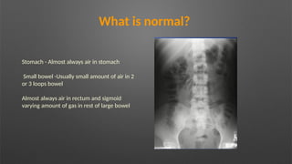 What is normal?
Stomach - Almost always air in stomach
Small bowel -Usually small amount of air in 2
or 3 loops bowel
Almost always air in rectum and sigmoid
varying amount of gas in rest of large bowel
 