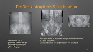 26
D = Dense structures & calcification
Only around 15% of
gallstones contain enough
calcium to be visible on a
plain radiograph.
Most renal stones (90%) contain enough calcium to be visible
on a plain radiograph
Radiolucent stones -uric acid stones are not visualised.
 