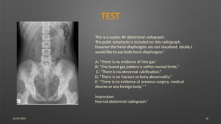12/03/2024 31
TEST
This is a supine AP abdominal radiograph.
The pubic symphysis is included on this radiograph,
however the hemi diaphragms are not visualised. Ideally I
‐
would like to see both hemi diaphragms”
‐
A: “There is no evidence of free gas.”
B: “The bowel gas pattern is within normal limits.”
C: “There is no abnormal calcification.”
D: “There is no fracture or bony abnormality.”
E: “There is no evidence of previous surgery, medical
devices or any foreign body.” “
Impression
Normal abdominal radiograph.”
 