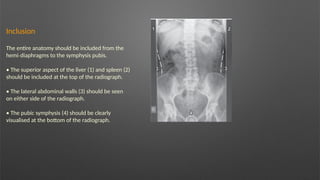 Inclusion
The entire anatomy should be included from the
hemi diaphragms to the symphysis pubis.
‐
• The superior aspect of the liver (1) and spleen (2)
should be included at the top of the radiograph.
• The lateral abdominal walls (3) should be seen
on either side of the radiograph.
• The pubic symphysis (4) should be clearly
visualised at the bottom of the radiograph.
 