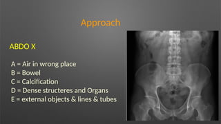 Approach
ABDO X
A = Air in wrong place
B = Bowel
C = Calcification
D = Dense structeres and Organs
E = external objects & lines & tubes
 