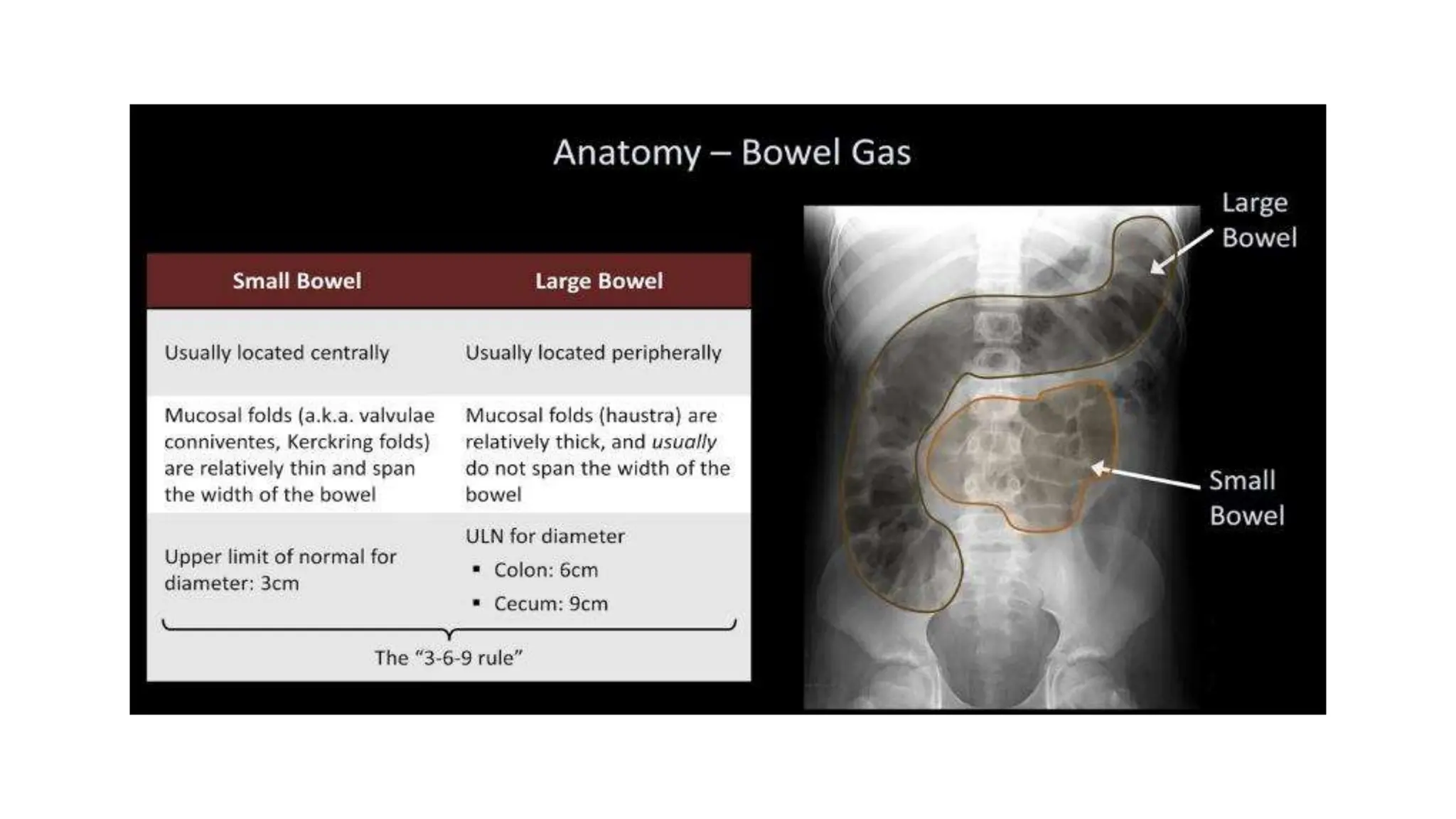 Abdominal Xray Interpretation For Surgery And 