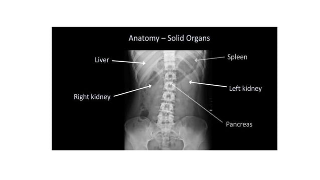 Abdominal Xray Interpretation For Surgery And 
