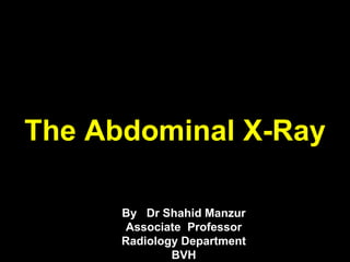 The Abdominal X-Ray
By Dr Shahid Manzur
Associate Professor
Radiology Department
BVH
 