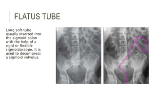 FLATUS TUBE
Long soft tube
usually inserted into
the sigmoid colon
with the help of a
rigid or flexible
sigmoidoscope. It is
used to decompress
a sigmoid volvulus.
 