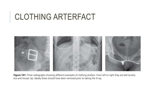 CLOTHING ARTERFACT
 