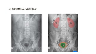4) ABDOMINAL VISCERA 2
 