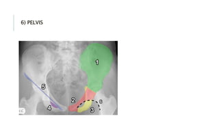6) PELVIS
 