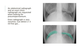 An abdominal radiograph
and an erect chest
radiograph are requested
when looking for
pneumoperitoneum.
Erect radiograph is very
sensitive. Can detect 2-3
ml free gas .
 