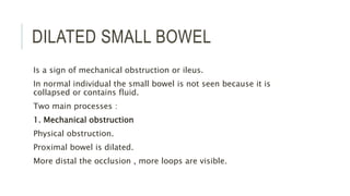 DILATED SMALL BOWEL
Is a sign of mechanical obstruction or ileus.
In normal individual the small bowel is not seen because it is
collapsed or contains fluid.
Two main processes :
1. Mechanical obstruction
Physical obstruction.
Proximal bowel is dilated.
More distal the occlusion , more loops are visible.
 