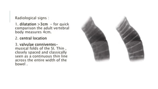 Radiological signs :
1. dilatation >3cm - for quick
comparison the adult vertebral
body measures 4cm.
2. central location
3. valvulae conniventes-
musical folds of the SI. Thin ,
closely spaced and classically
seen as a continuous thin line
across the entire width of the
bowel .
 