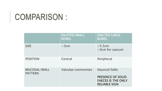 COMPARISON :
DILATED SMALL
BOWEL
DIALTED LARGE
BOWEL
SIZE >3cm >5.5cm
>9cm for caecum
POSITION Central Peripheral
MUCOSAL/WALL
PATTERN
Valvulae conniventes Haustral folds
PRESENCE OF SOLID
FAECES IS THE ONLY
RELIABLE SIGN
 