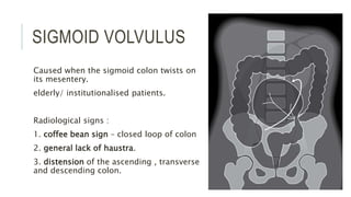 SIGMOID VOLVULUS
Caused when the sigmoid colon twists on
its mesentery.
elderly/ institutionalised patients.
Radiological signs :
1. coffee bean sign – closed loop of colon
2. general lack of haustra.
3. distension of the ascending , transverse
and descending colon.
 
