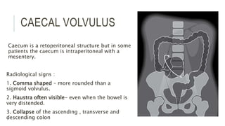 CAECAL VOLVULUS
Caecum is a retoperitoneal structure but in some
patients the caecum is intraperitoneal with a
mesentery.
Radiological signs :
1. Comma shaped – more rounded than a
sigmoid volvulus.
2. Haustra often visible- even when the bowel is
very distended.
3. Collapse of the ascending , transverse and
descending colon
 