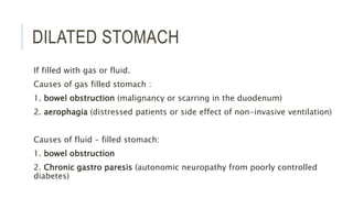 DILATED STOMACH
If filled with gas or fluid.
Causes of gas filled stomach :
1. bowel obstruction (malignancy or scarring in the duodenum)
2. aerophagia (distressed patients or side effect of non-invasive ventilation)
Causes of fluid – filled stomach:
1. bowel obstruction
2. Chronic gastro paresis (autonomic neuropathy from poorly controlled
diabetes)
 