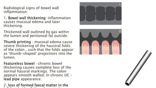 Radiological signs of bowel wall
inflammation:
1. Bowel wall thickening: inflammation
causes mucosal edema and later
thickening.
Thickened wall outlined by gas within
the lumen and peritoneal fat outside.
Thumb printing : mucosal edema cause
severe thickening of the haustral folds
of the colon , such that the folds appear
as ‘thumb-shaped’ projections into the
lumen.
Featureless bowel : chronic bowel
thickening causes complete loss of the
normal hausral markings. The colon
appears smooth walled. In chronic UC –
lead pipe appearance.
2. loss of formed faecal matter in the
 