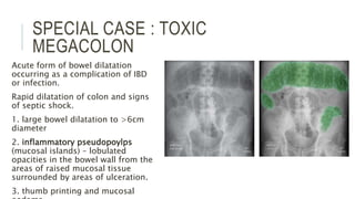 SPECIAL CASE : TOXIC
MEGACOLON
Acute form of bowel dilatation
occurring as a complication of IBD
or infection.
Rapid dilatation of colon and signs
of septic shock.
1. large bowel dilatation to >6cm
diameter
2. inflammatory pseudopoylps
(mucosal islands) – lobulated
opacities in the bowel wall from the
areas of raised mucosal tissue
surrounded by areas of ulceration.
3. thumb printing and mucosal
 