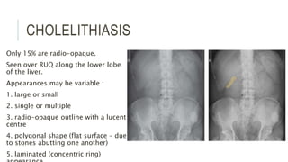 CHOLELITHIASIS
Only 15% are radio-opaque.
Seen over RUQ along the lower lobe
of the liver.
Appearances may be variable :
1. large or small
2. single or multiple
3. radio-opaque outline with a lucent
centre
4. polygonal shape (flat surface – due
to stones abutting one another)
5. laminated (concentric ring)
 