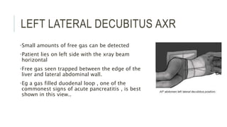 LEFT LATERAL DECUBITUS AXR
•Small amounts of free gas can be detected
•Patient lies on left side with the xray beam
horizontal
•Free gas seen trapped between the edge of the
liver and lateral abdominal wall.
•Eg a gas filled duodenal loop , one of the
commonest signs of acute pancreatitis , is best
shown in this view..
 
