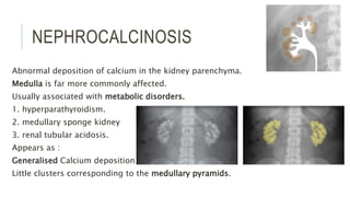 NEPHROCALCINOSIS
Abnormal deposition of calcium in the kidney parenchyma.
Medulla is far more commonly affected.
Usually associated with metabolic disorders.
1. hyperparathyroidism.
2. medullary sponge kidney
3. renal tubular acidosis.
Appears as :
Generalised Calcium deposition
Little clusters corresponding to the medullary pyramids.
 