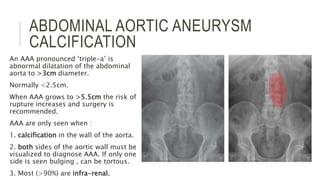 ABDOMINAL AORTIC ANEURYSM
CALCIFICATION
An AAA pronounced ‘triple-a’ is
abnormal dilatation of the abdominal
aorta to >3cm diameter.
Normally <2.5cm.
When AAA grows to >5.5cm the risk of
rupture increases and surgery is
recommended.
AAA are only seen when :
1. calcification in the wall of the aorta.
2. both sides of the aortic wall must be
visualized to diagnose AAA. If only one
side is seen bulging , can be tortous.
3. Most (>90%) are infra-renal.
 