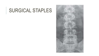 SURGICAL STAPLES
 