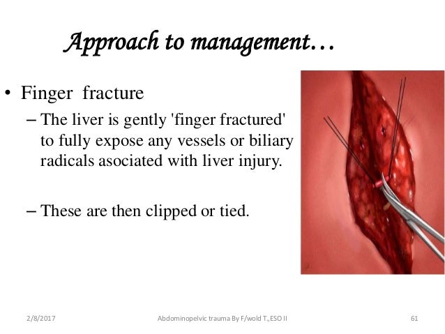 blunt injury to the hepatic flexture