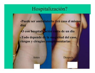 Hospitalización?

-Puede ser ambulatoria (irá casa el mismo
día)
-O con hospitalización corta de un día
-Todo depende de la magnitud del caso,
riesgos y cirugías complementarias



        Antes                 Después
                               Francisco Villegas
                               Cirujano Plástico
 