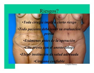 Riesgos?

  •Toda cirugía implica cierto riesgo
•Todo paciente debe tener su evaluación
                previa
   •Exámenes antes de la operación
   •Cita previa con el anestesiólogo
 •Elegir institución de salud adecuada
         •Cirujano confiable Francisco Villegas
                                    Cirujano Plástico
 