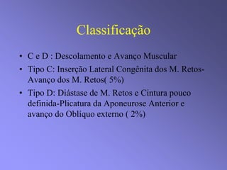 Classificação
• C e D : Descolamento e Avanço Muscular
• Tipo C: Inserção Lateral Congênita dos M. Retos-
Avanço dos M. Retos( 5%)
• Tipo D: Diástase de M. Retos e Cintura pouco
definida-Plicatura da Aponeurose Anterior e
avanço do Oblíquo externo ( 2%)
 