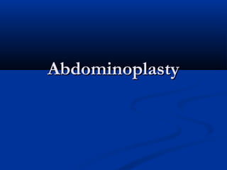 Abdominoplasty

 