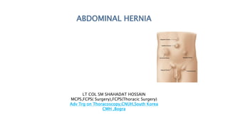 ABDOMINAL HERNIA
LT COL SM SHAHADAT HOSSAIN
MCPS,FCPS( Surgery),FCPS(Thoracic Surgery)
Adv Trg on Thoracoscopy,CNUH,South Korea
CMH ,Bogra
 