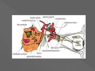 6 th nerve palsy | PDF