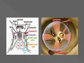 6 th nerve palsy | PDF