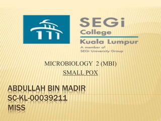ABDULLAH BIN MADIR
SC-KL-00039211
MISS
MICROBIOLOGY 2 (MBI)
SMALL POX
 