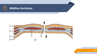 Full Midline Incision Abdominal wall anatomy wall anatomy.pptx