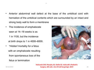Gastroschisis and omphalocele ; congenital abdominal wall defects | PPTX