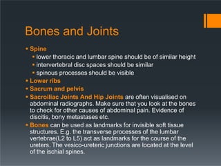 Bones and Joints
 Spine
 lower thoracic and lumbar spine should be of similar height
 intervertebral disc spaces should be similar
 spinous processes should be visible
 Lower ribs
 Sacrum and pelvis
 Sacroiliac Joints And Hip Joints are often visualised on
abdominal radiographs. Make sure that you look at the bones
to check for other causes of abdominal pain. Evidence of
discitis, bony metastases etc.
 Bones can be used as landmarks for invisible soft tissue
structures. E.g. the transverse processes of the lumbar
vertebrae(L2 to L5) act as landmarks for the course of the
ureters. The vesico-ureteric junctions are located at the level
of the ischial spines.
 