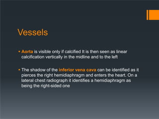Vessels
 Aorta is visible only if calcified It is then seen as linear
calcification vertically in the midline and to the left
 The shadow of the inferior vena cava can be identified as it
pierces the right hemidiaphragm and enters the heart. On a
lateral chest radiograph it identifies a hemidiaphragm as
being the right-sided one
 