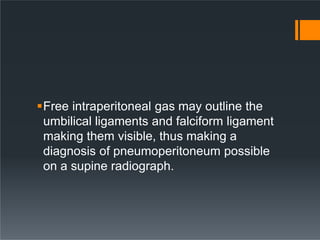 Free intraperitoneal gas may outline the
umbilical ligaments and falciform ligament
making them visible, thus making a
diagnosis of pneumoperitoneum possible
on a supine radiograph.
 