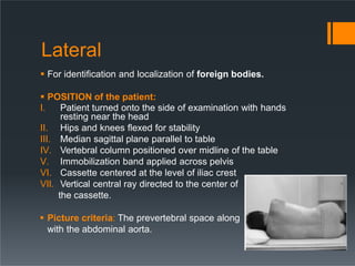 Lateral
 For identification and localization of foreign bodies.
 POSITION of the patient:
I. Patient turned onto the side of examination with hands
resting near the head
II. Hips and knees flexed for stability
III. Median sagittal plane parallel to table
IV. Vertebral column positioned over midline of the table
V. Immobilization band applied across pelvis
VI. Cassette centered at the level of iliac crest
VII. Vertical central ray directed to the center of
the cassette.
 Picture criteria: The prevertebral space along
with the abdominal aorta.
 