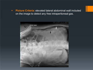  Picture Criteria: elevated lateral abdominal wall included
on the image to detect any free intraperitoneal gas.
 