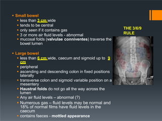  Small bowel
 less than 3 cm wide
 tends to be central
 only seen if it contains gas
 3 or more air fluid levels - abnormal
 mucosal folds (valvulae conniventes) traverse the
bowel lumen
 Large bowel
 less than 6 cm wide, caecum and sigmoid up to 9
cm
 peripheral
 ascending and descending colon in fixed positions
laterally
 transverse colon and sigmoid variable position on a
mesentery
 Haustral folds do not go all the way across the
lumen
 Any air fluid levels – abnormal (?)
 Numerous gas – fluid levels may be normal and
18% of normal films have fluid levels in the
caecum
 contains faeces - mottled appearance
THE 3/6/9
RULE
 