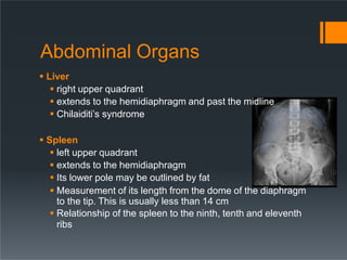 Abdominal Organs
 Liver
 right upper quadrant
 extends to the hemidiaphragm and past the midline
 Chilaiditi’s syndrom...