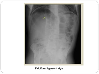 abdominal x ray radiology | PPTX