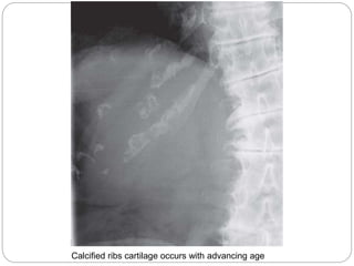 abdominal x ray radiology | PPTX