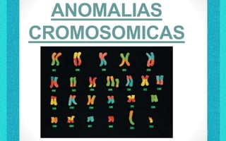 ANOMALIAS
CROMOSOMICAS
LUGO BALDERAS JOSE LUIS
 